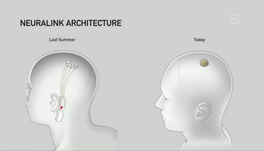 Neuralink